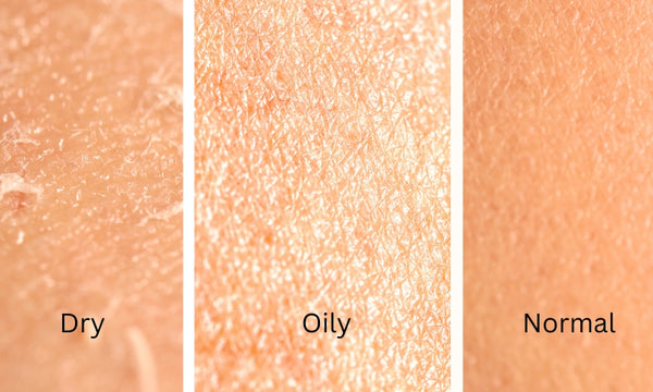 All skin types
